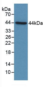 Polyclonal Antibody to Complement Component 4d (C4d)