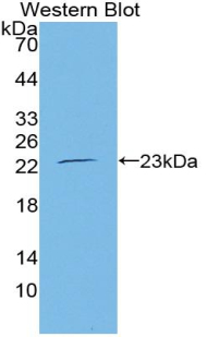 Polyclonal Antibody to Vascular Endothelial Growth Factor 145 (VEGF145)