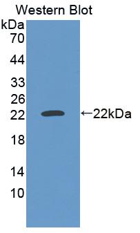 Polyclonal Antibody to SCAN Domain Containing Protein 3 (SCAND3)