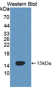 Polyclonal Antibody to Occludin/ELL Domain Containing Protein 1 (OCEL1)