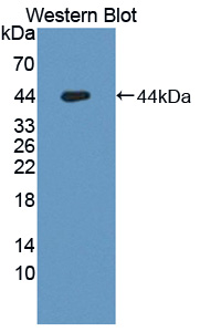 Polyclonal Antibody to Occludin/ELL Domain Containing Protein 1 (OCEL1)