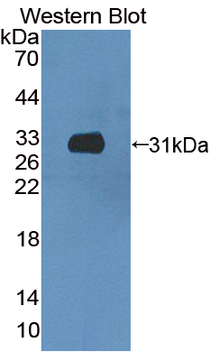 Polyclonal Antibody to Coiled Coil Domain Containing Protein 60 (CCDC60)