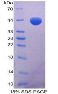 Recombinant Monocyte Chemotactic Protein 1 (MCP1)