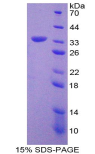 Recombinant Monocyte Chemotactic Protein 3 (MCP3)
