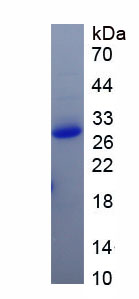 Recombinant Collagen Type IV Alpha 1 (COL4a1)