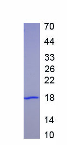 Recombinant Carbohydrate Antigen 125 (C<b>A125</b>)