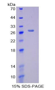 Recombinant Creatine Kinase, Mitochondrial 1A (CKMT1A)