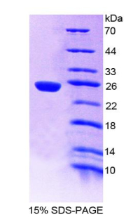 Recombinant Proteasome subunit beta type-9 (PSMB9)