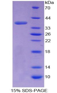 Recombinant Transition Protein 1 (TNP1)