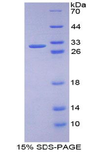 Recombinant Protein Kinase D1 (PKD1)
