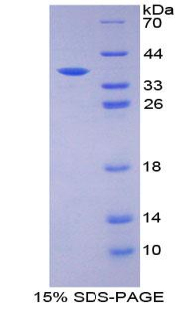 Recombinant Protein Kinase R (PKR)