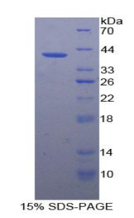 Recombinant Vascular Cell Adhesion Molecule 1 (VCAM1)