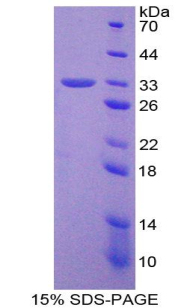 Recombinant Telomerase protein component 1 (TEP1)