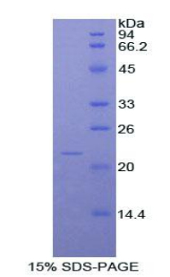 Recombinant Nitric Oxide Synthase 2, Inducible (NOS2)