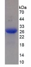 Recombinant Mannose Associated Serine Protease 2 (MASP2)
