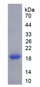 Recombinant Cluster Of Differentiation 26 (CD26)