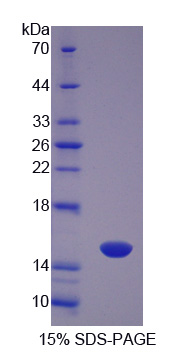 Recombinant Cluster Of Differentiation 26 (CD26)