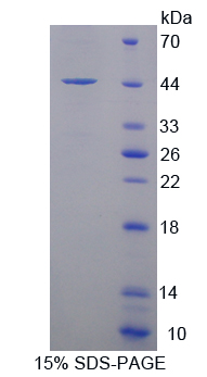 Recombinant Gamma-synuclein (SNCG)