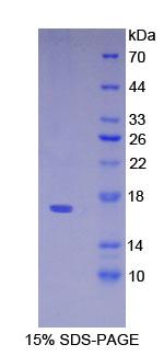 Recombinant Pre-B-Lymphocyte Gene 1 (VPREB1)