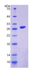 Recombinant Signal Regulatory Protein Beta 1 (SIRPb1)