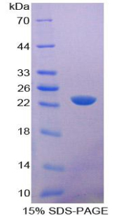 Recombinant Cluster Of Differentiation 6 (CD6)