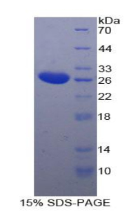 Recombinant Tubulin Polymerization Promoting Protein (TPPP)