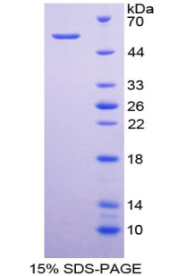 Recombinant Cluster Of Differentiation 320 (C<b>D320</b>)