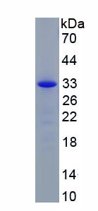 Recombinant Angiopoietin Like Protein 4 (ANGPTL4)