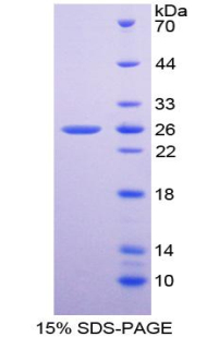 Recombinant Superoxide Dismutase 2, Mitochondrial (SOD2)