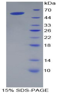 Recombinant Cluster Of Differentiation 8a (CD8a)