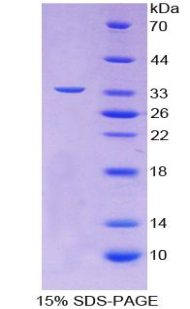 Recombinant Cluster Of Differentiation 42b (CD42b)