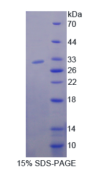 Recombinant Nucleoporin 85 (NUP85)