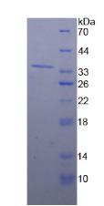 Recombinant Nucleoporin 98 (NUP98)