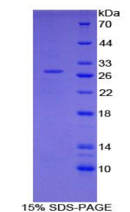 Recombinant Nucleoporin 98 (NUP98)