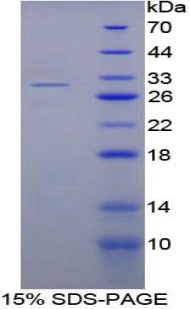 Recombinant Nucleoporin 88 (NUP88)