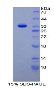 Recombinant Nucleoporin 88 (NUP88)