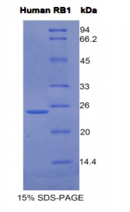 Recombinant Retinoblastoma Protein 1 (RB1)