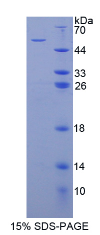 Recombinant Programmed Cell Death Protein 6 Interacting Protein (PDCD6IP)