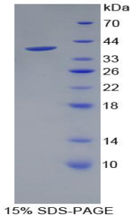 Recombinant Pancreatic Polypeptide (PP)