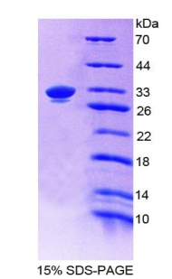 Recombinant Epithelial Cell Adhesion Molecule (EPCAM)