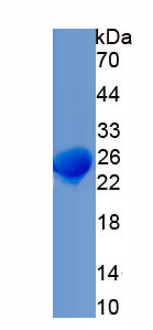 Recombinant Elastin (ELN)