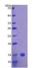 Recombinant Adenylyl Cyclase Associated Protein 1 (CAP1)