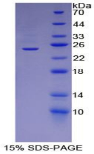 Recombinant Adipose Differentiation Related Protein (ADRP)