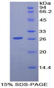 Recombinant Cluster of Differentiation 79B (CD79B)