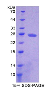 Recombinant Adenylate Cyclase 4 (ADCY4)