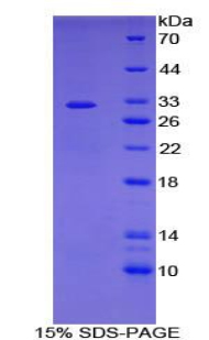 Recombinant Adenylate Cyclase 7 (ADCY7)