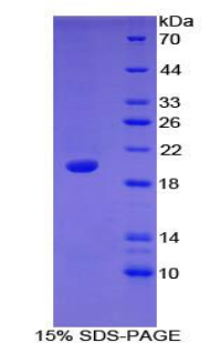 Recombinant Nuclear Pore Glycoprotein 210 (gp210)
