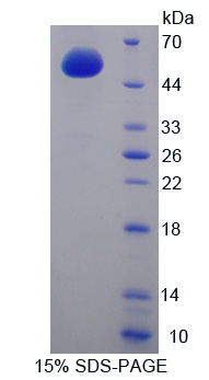 Recombinant Adenylate Cyclase 9 (ADCY9)