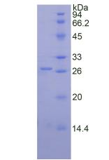 Recombinant Proteinase 3 (PR3)