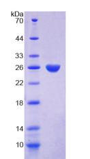 Recombinant Proteinase 3 (PR3)